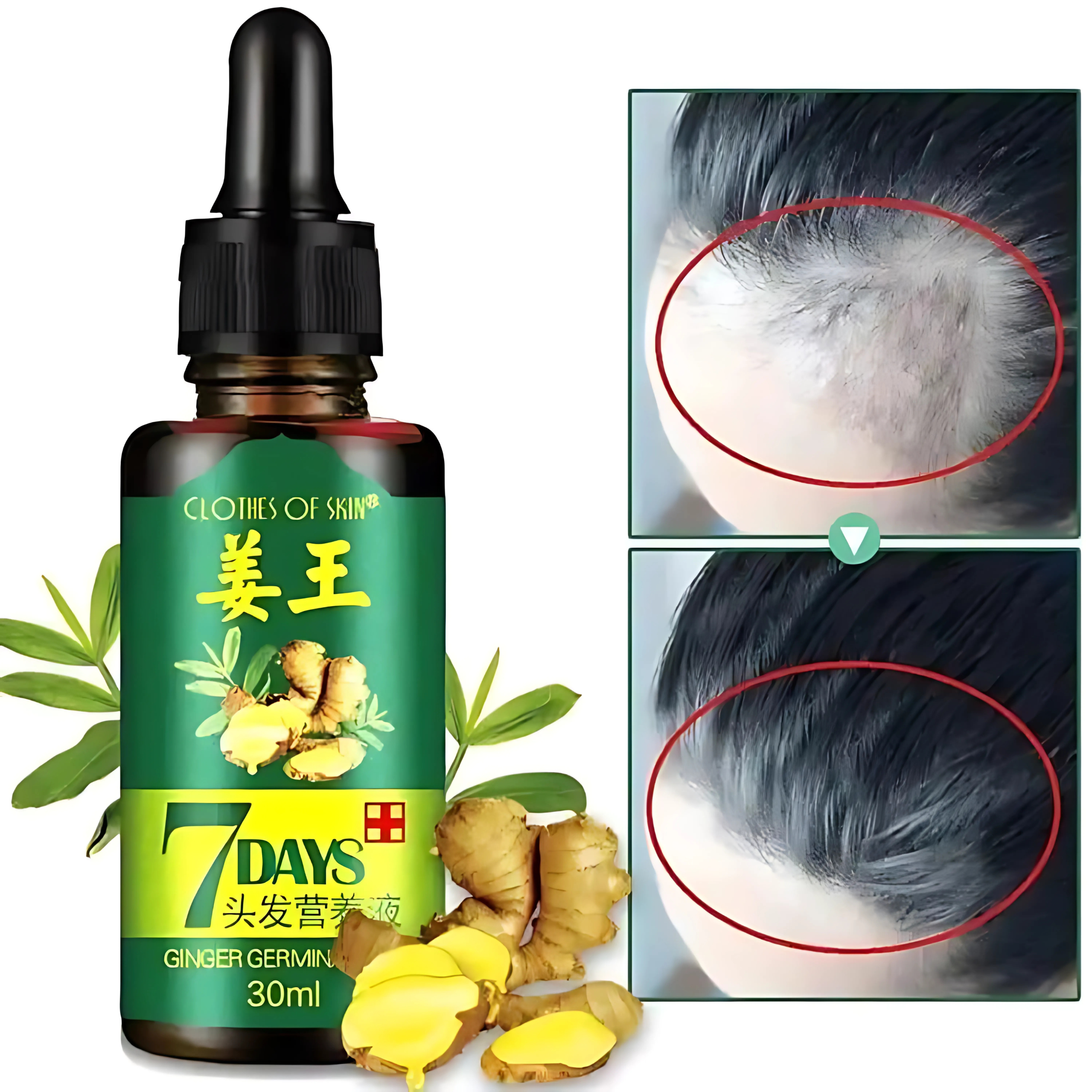 Nourishing Hair Growth Serum - 30ml | For All Hair Types | Boosts Regrowth & Reduces Hair Fall