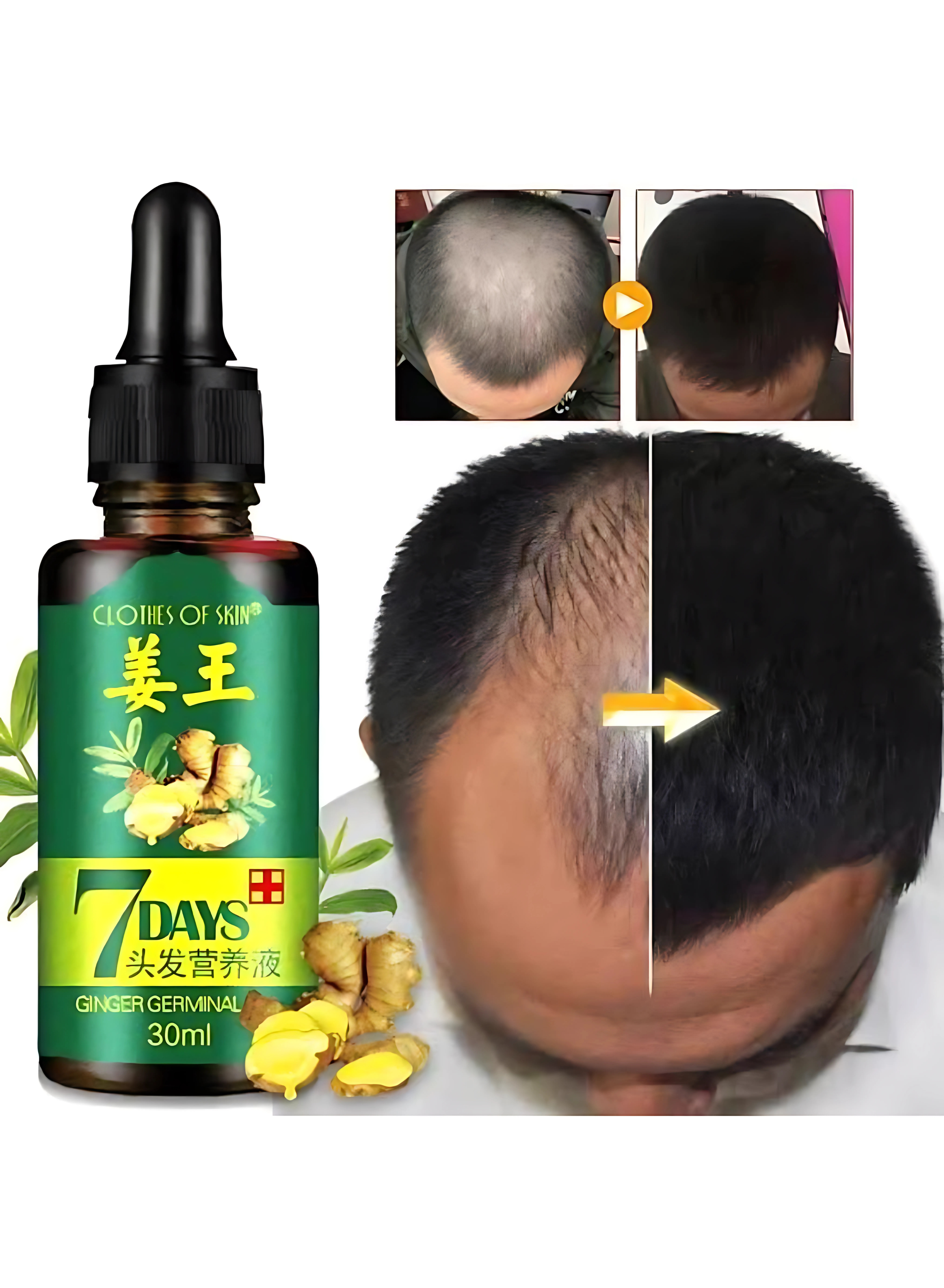 Nourishing Hair Growth Serum - 30ml | For All Hair Types | Boosts Regrowth & Reduces Hair Fall