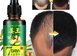 Nourishing Hair Growth Serum - 30ml | For All Hair Types | Boosts Regrowth & Reduces Hair Fall